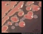 salmonella and klebsiella colony